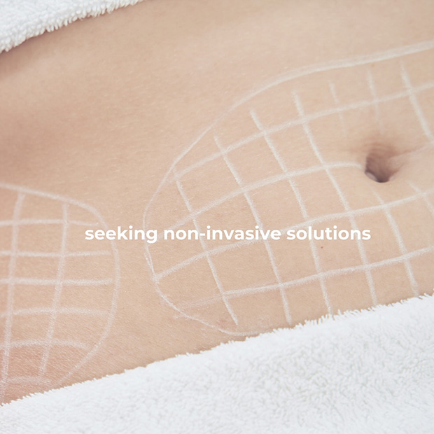 Microneedling For Stretch Marks