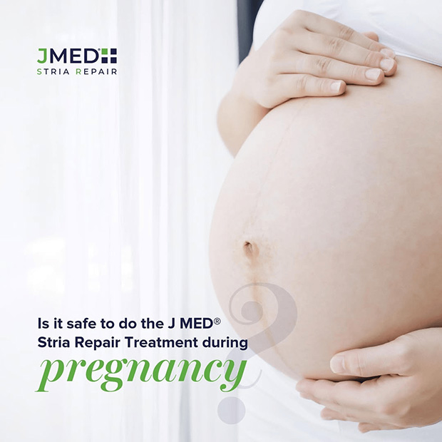 Safe Stretch Mark Removal For Pregnant Women