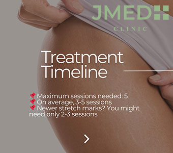 How Long Does It Take To Remove Stretch Marks