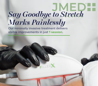 What is the Most Effective Stretch Mark Removal Treatment?