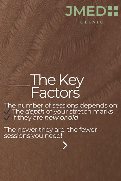 How JMED Stria Repair Works No Pain, No Downtime How JMED Stria Repair Works No Pain, No Downtime