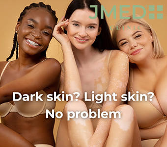 How to Get the Best Results for Stretch Marks (Backed by Science) How to Get the Best Results for Stretch Marks (Backed by Science)