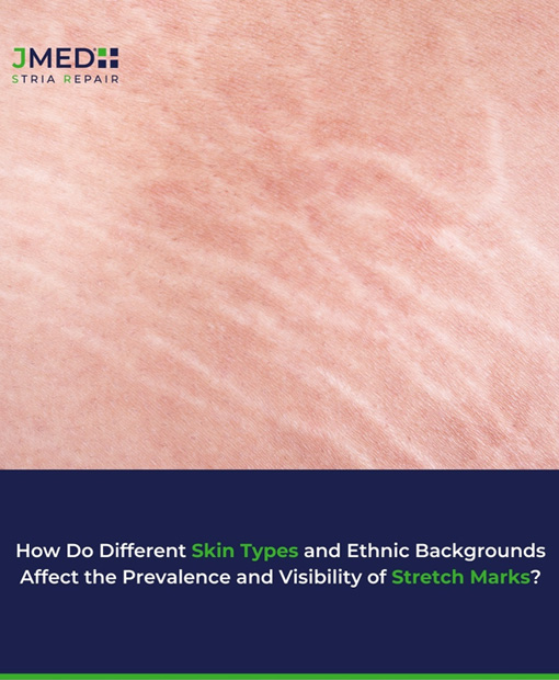 Stretch Marks Treatment Kuwait