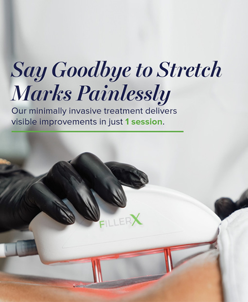 Stretch Mark Specialist Muscat