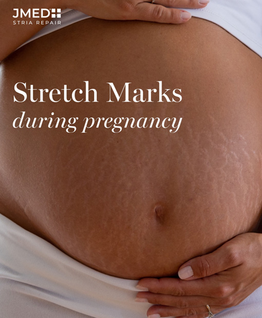 Stretch Mark Removal Clinic In Oman