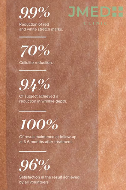 The JMED Stria Repair Method The JMED Stria Repair Method