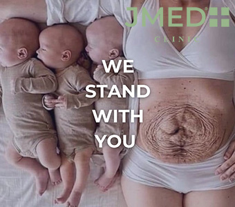 How to Prevent Stretch Marks During Pregnancy: Expert Tips That Work