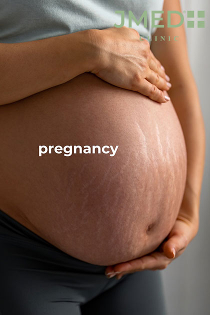 Pregnancy Stretch Marks Removal in Dubai