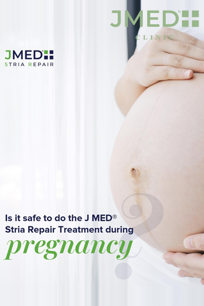 Prevent Stretch Marks During Pregnancy in Dubai