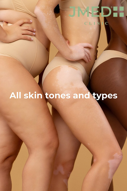 celebrities stretch marks removal in Dubai