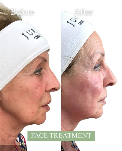 Best Aesthetic Clinic In Bluewaters Island Best Aesthetic Clinic In Bluewaters Island