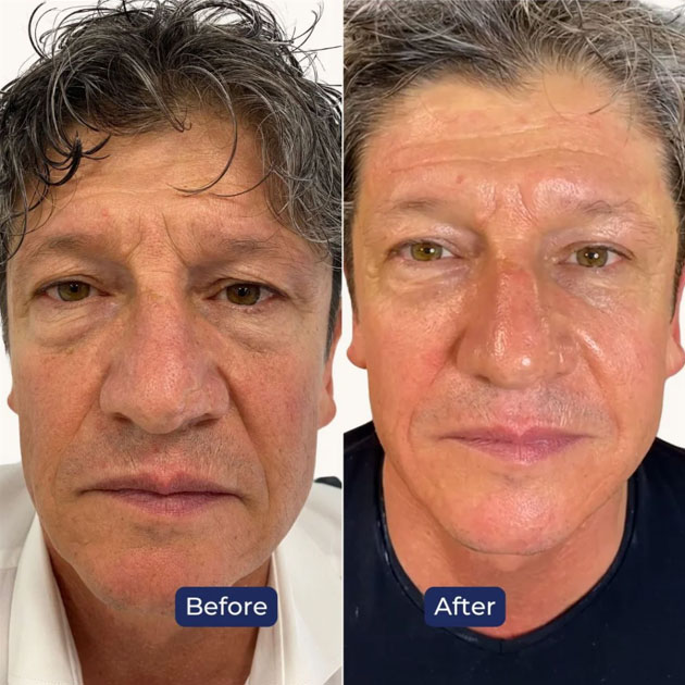 Best Skin Clinic Bluewaters Island Best Skin Clinic Bluewaters Island