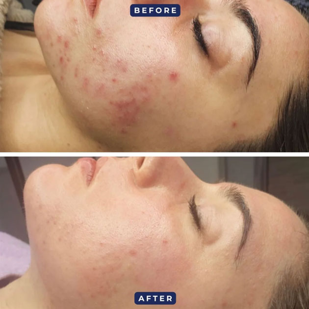 Skin Care Expert In Business Bay Skin Care Expert In Business Bay