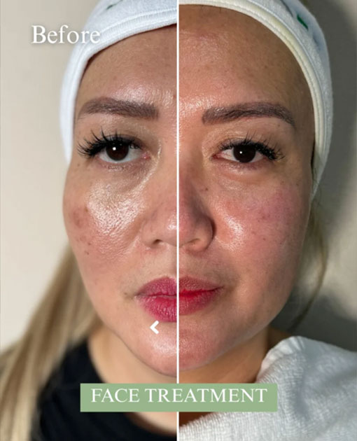 Skin Care Expert In Downtown Dubai Skin Care Expert In Downtown Dubai