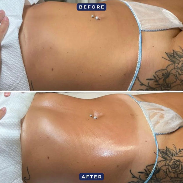 Best Skin Clinic In Emirates Hills