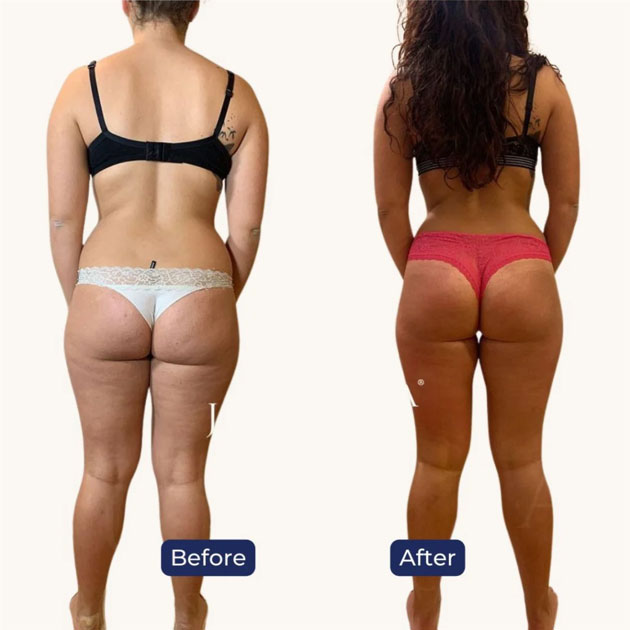 Skin Care Clinic In JBR