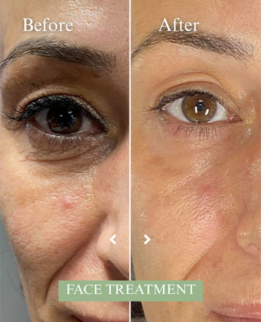 Aesthetic Clinic Near Jumeirah Lake Towers