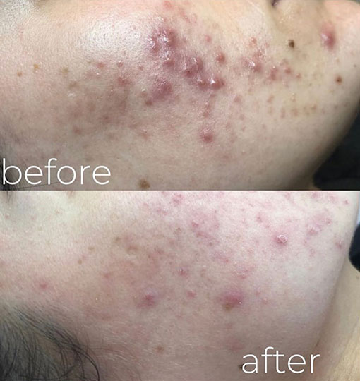 Skin Care Clinic Near Jumeirah Park Skin Care Clinic Near Jumeirah Park