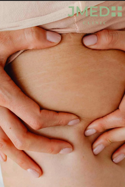 Plastic Surgery vs. Body Treatments Dubai Plastic Surgery vs. Body Treatments Dubai