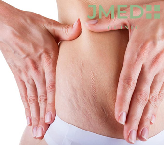 Plastic Surgery vs. Body Treatments