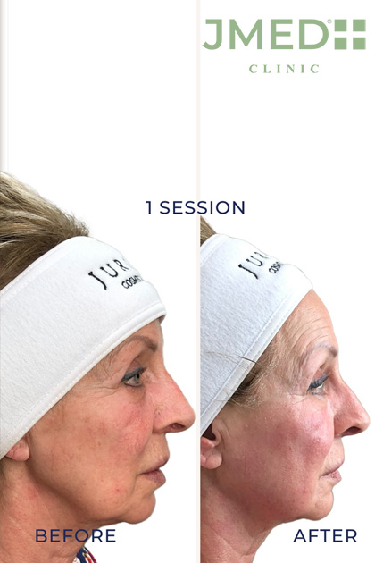 Post Plastic Surgery Recovery Treatments in Dubai Post Plastic Surgery Recovery Treatments in Dubai