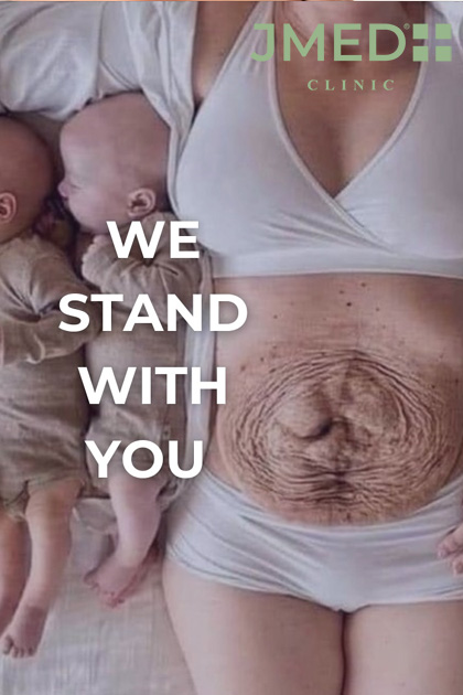 treat stretch marks during pregnancy treat stretch marks during pregnancy