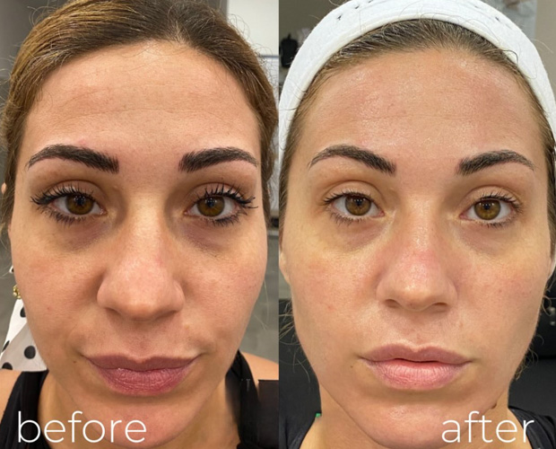 Best Aesthetic Clinic in Dubai Marina Best Aesthetic Clinic in Dubai Marina