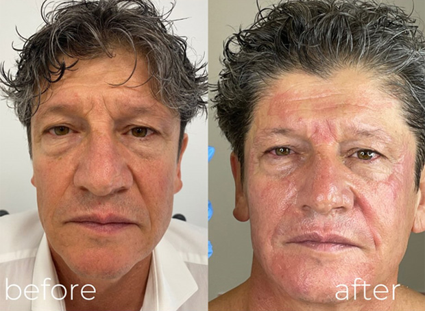 Best Aesthetic Clinic near Dubai Marina Best Aesthetic Clinic near Dubai Marina