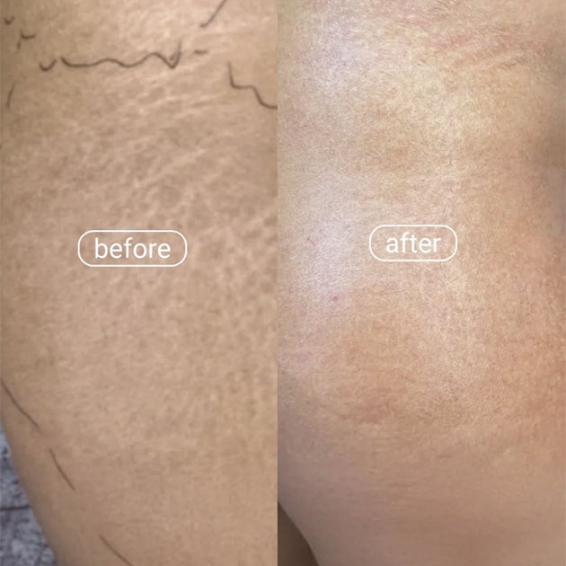 Skin Care Clinic In JBR