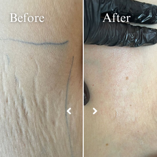 Best Aesthetics Clinic JBR