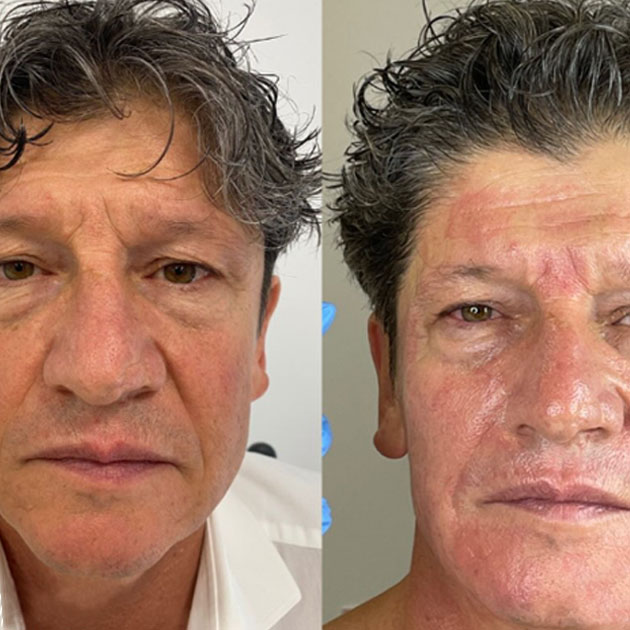 Best Skin Clinic In Jumeirah Golf Estates