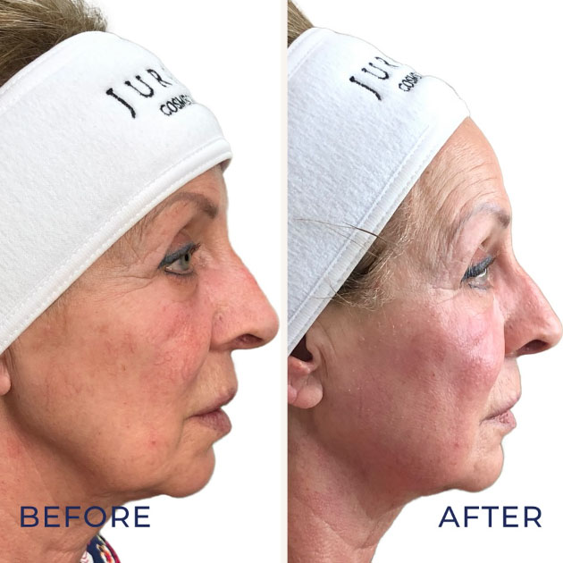 Skin Care Expert Jumeirah Golf Estates