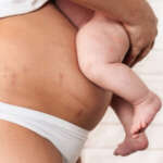 Body Contouring After Pregnancy: What You Should Know About Regaining Your Confidence Naturally