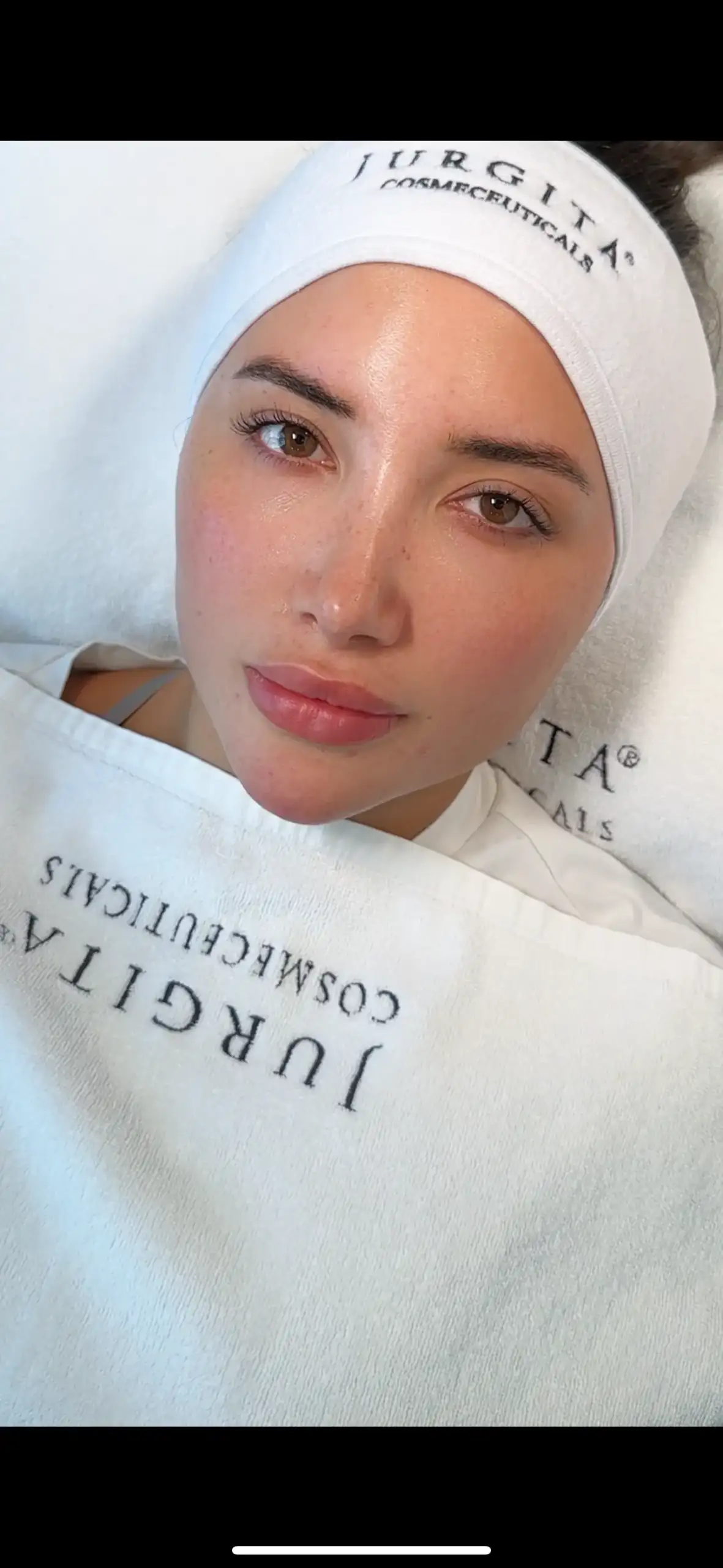 Best Facial For Bride Before Marriage