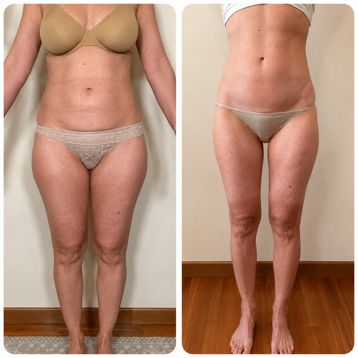 Weight Loss