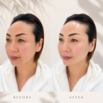 Glass Skin Facials: The Ultimate Skin Glowing Treatment for Clear, Hydrated & Glowing Skin