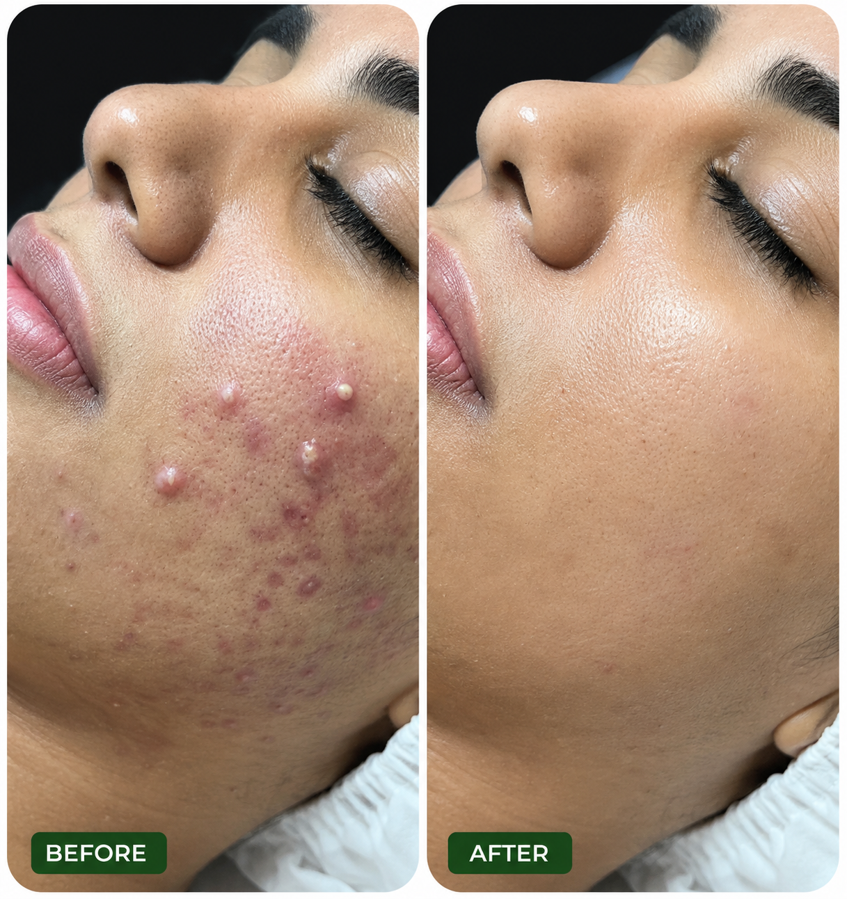 Treatment 6