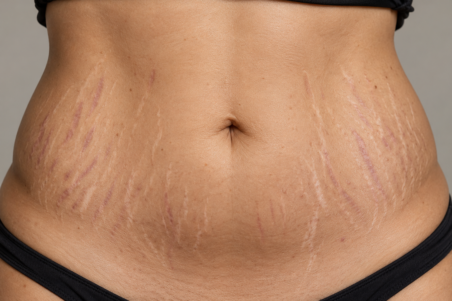 Illustrative skin appearance before treatment