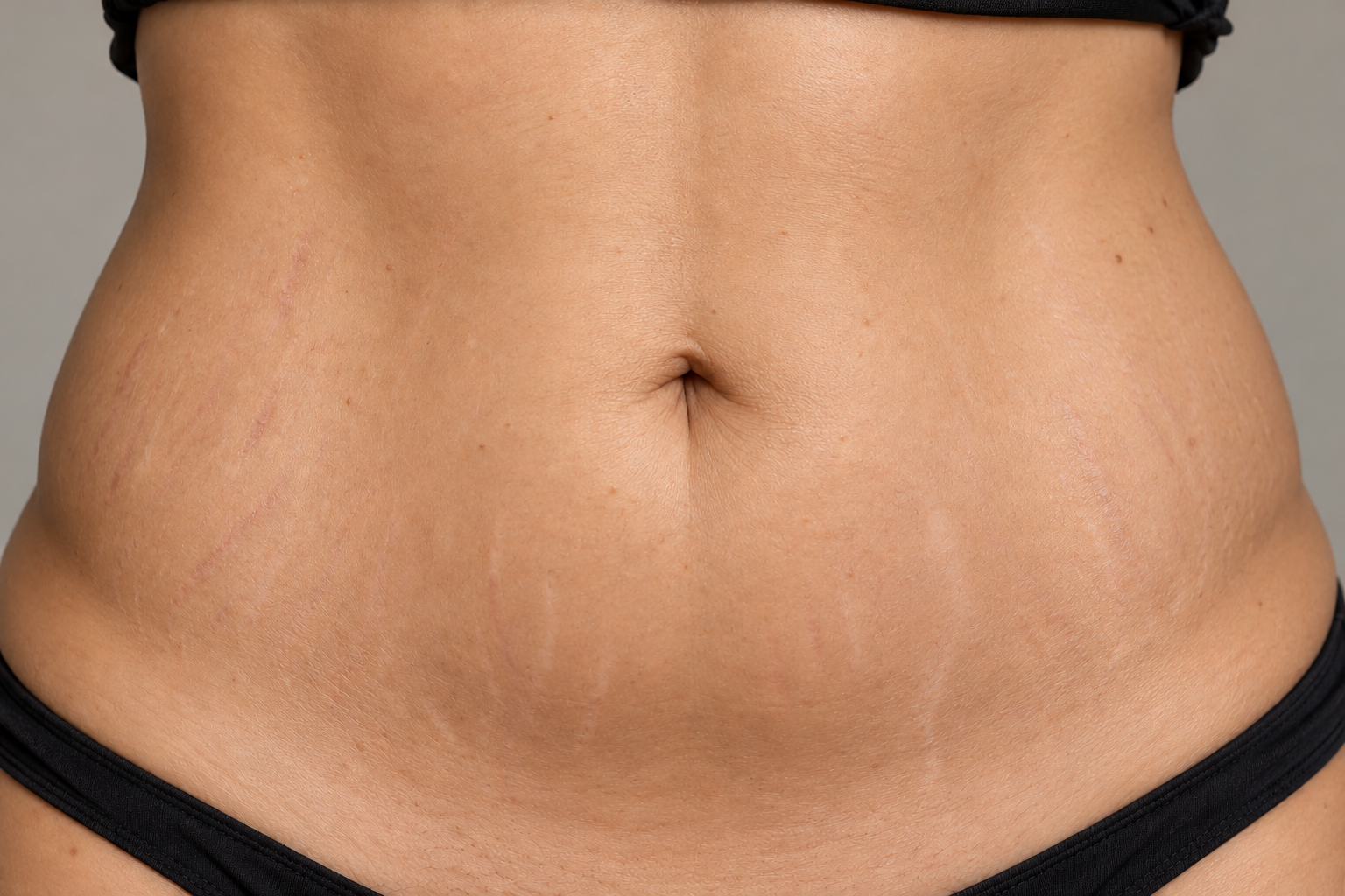 Illustrative skin appearance after treatment