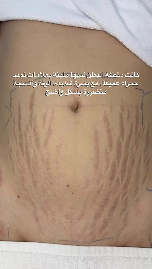 Instagram post 18086306939209200