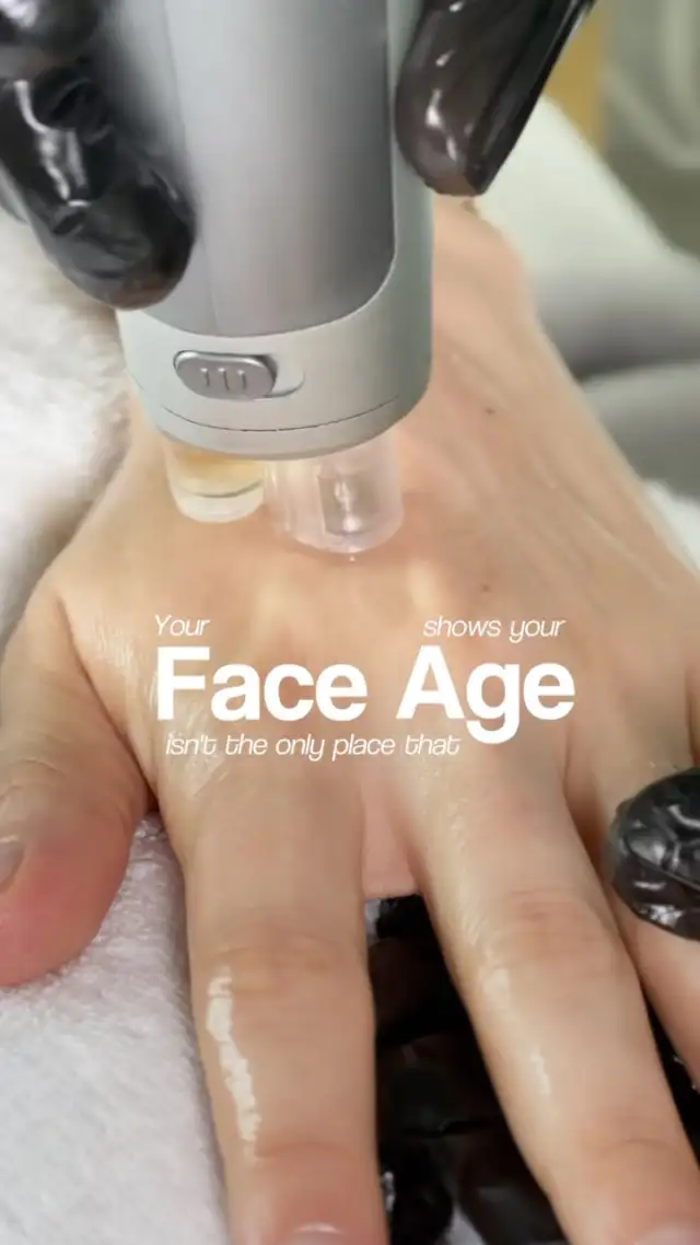 HAND REJUVENATION AT @jmedofficial ✨

Advanced LUMIX BBL Technology helps improve pigmentation, sun damage and uneven skin tone while restoring a brighter, smoother and more rejuvenated appearance to the hands.

Because youthful-looking skin shouldn’t stop at the face. 💚

DM to Book Your Consultation