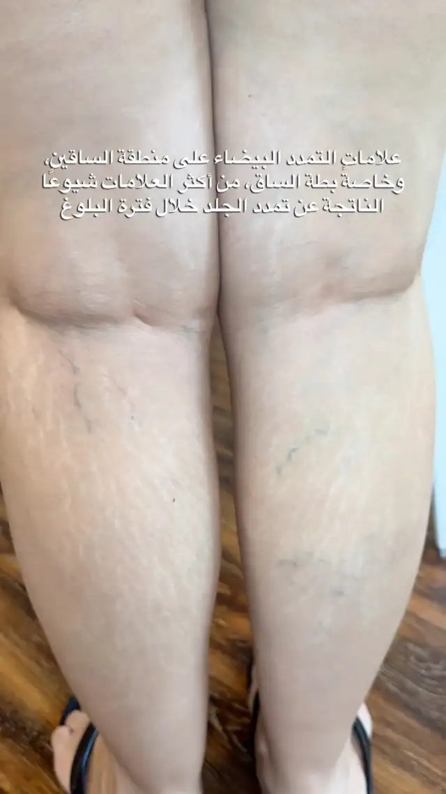 Instagram post 18075697712700878