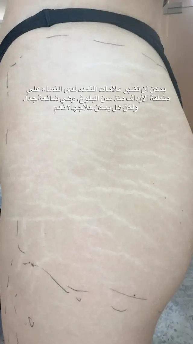 Instagram post 18110006984011077