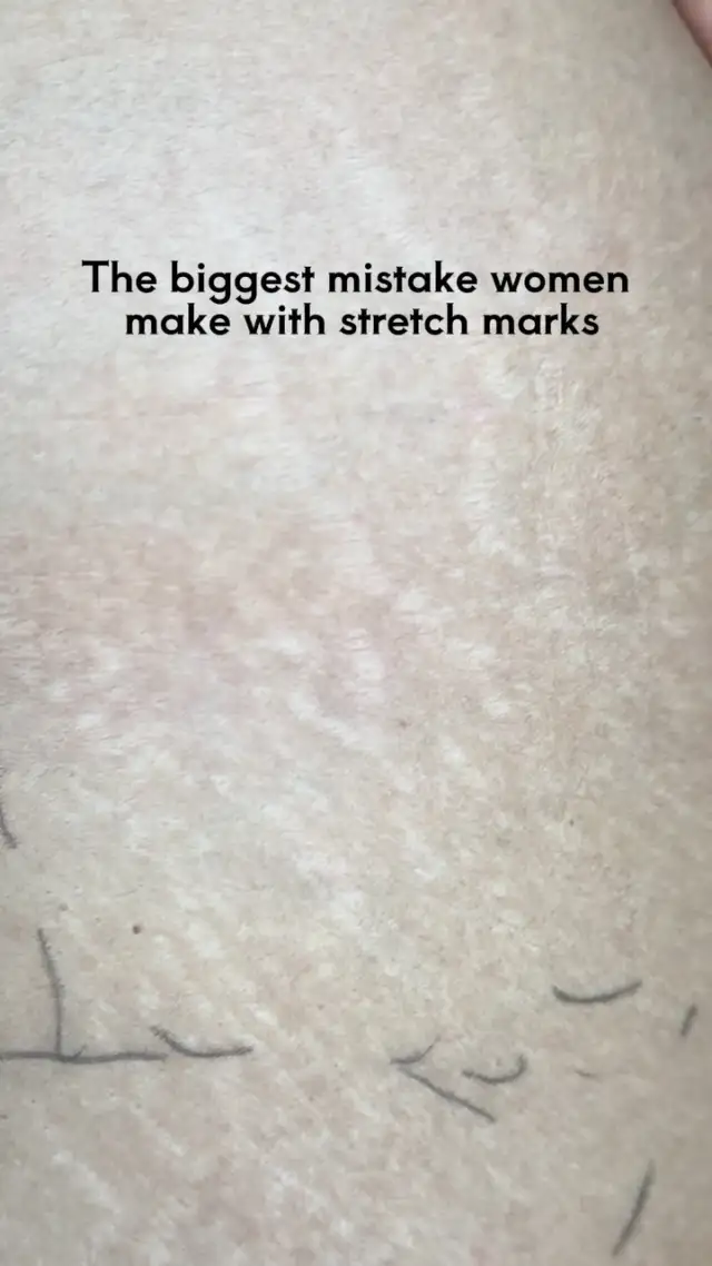 Instagram post 18083562842443732
